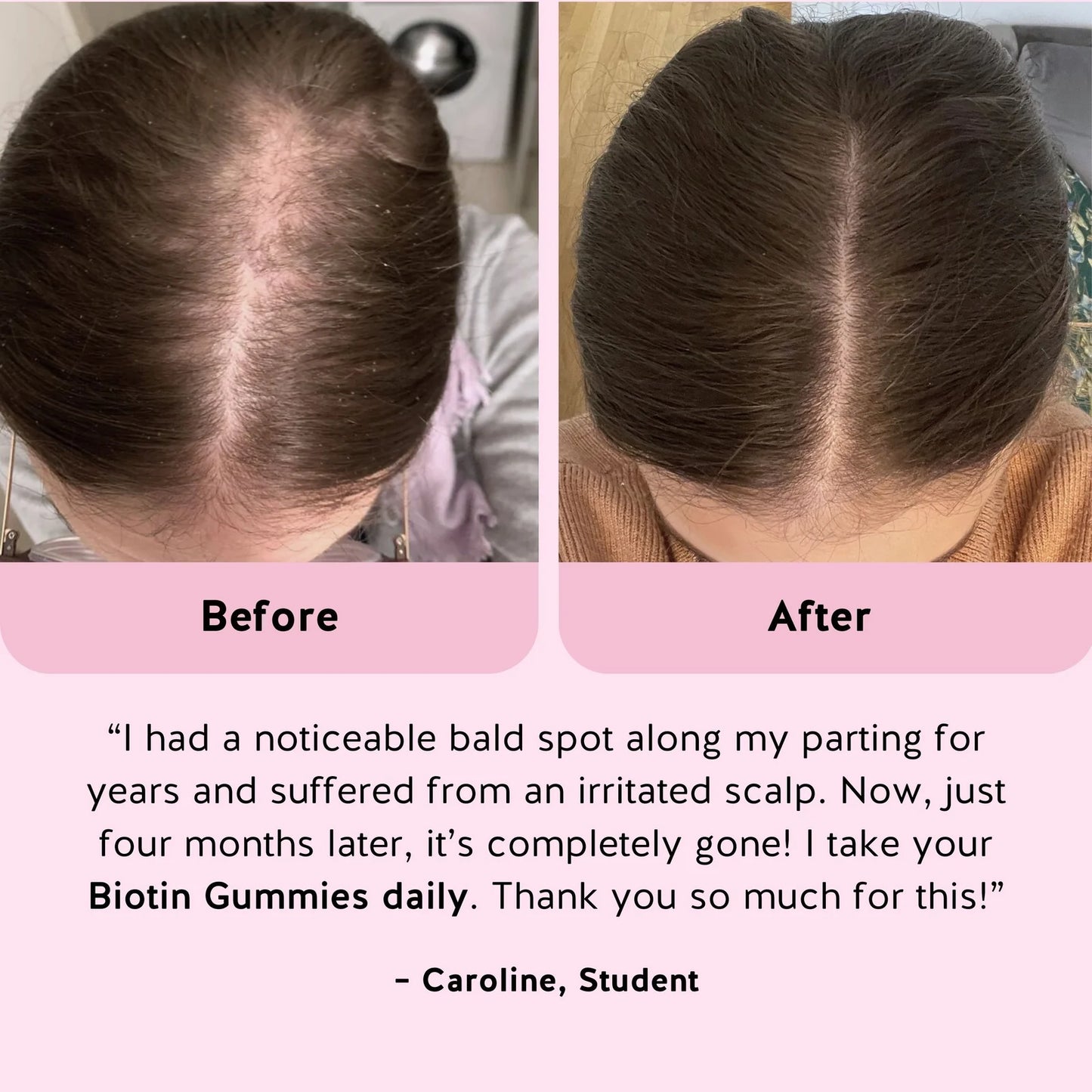 Ah-mazing Hair Vitamins